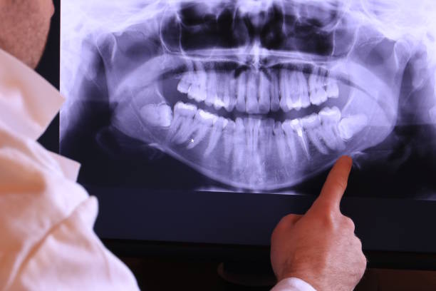 Best Emergency Dental Care for Broken or Chipped Teeth in North Braddock, PA